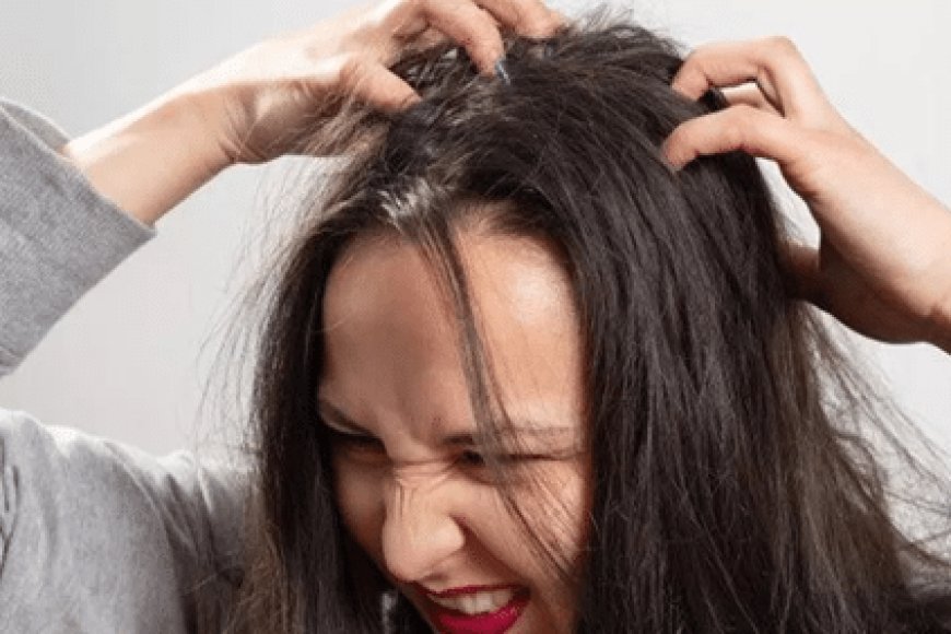 11 Cara Menghilangkan Ketombe yang Membandel dengan Mudah