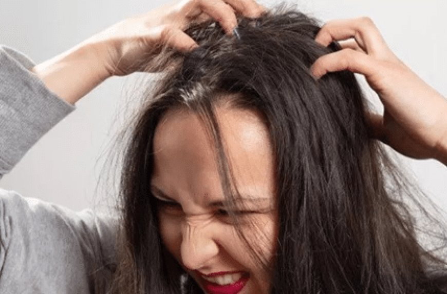 11 Cara Menghilangkan Ketombe yang Membandel dengan Mudah