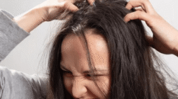 11 Cara Menghilangkan Ketombe yang Membandel dengan Mudah